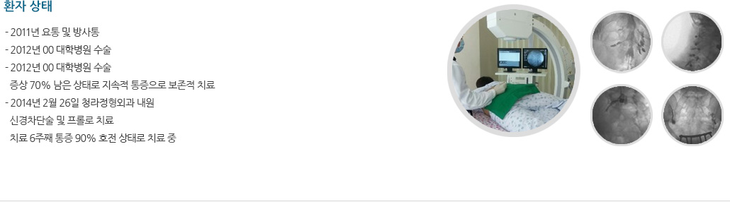 환자 상태 - 2011년 요통 및 방사통. - 2012년 00 대학병원 수술. - 2012년 00 대학병원 수술, 증상 70% 남은 상태로 지속적 통증으로 보존적 치료. - 2014년 2월 26일 청라정형외과 내원, 신경차단술 및 프롤로 치료, 치료 6주째 통증 90% 호전 상태로 치료 중
