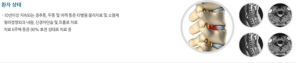 환자 상태 - 10년이상 지속되는 경추통, 두통 및 어깨 통증 타병원 물리치료 및 소염제, 청라정형외과 내원, 신경차단술 및 프롤로 치료, 치료 6주째 통증 90% 호전 상태로 치료 중